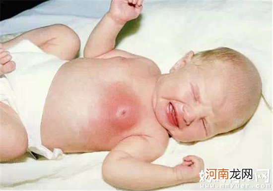 新生女婴要不要挤乳头 关于新生儿乳头护理要注意