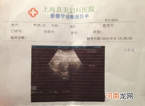 怀孕4个月胎儿图(b超图）