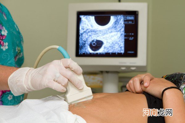 怀孕两个月听不到胎心正常吗 最晚多少天有胎心胎芽