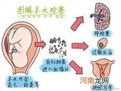 孕期如何预防羊水栓塞