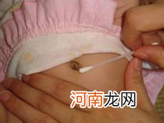 新生儿脐炎的护理 保持清洁干燥防止污染
