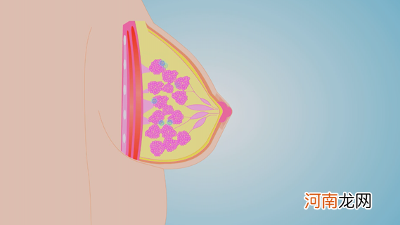 乳腺造影3类严重吗