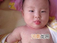 宝宝热痱的处理与预防好方法