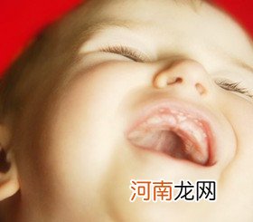 婴幼儿的马牙不属于病态