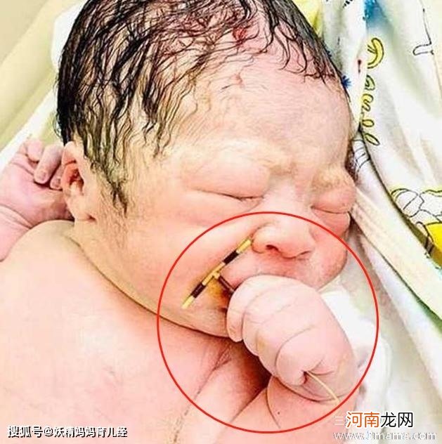 带环也意外怀孕 宝宝是留不是流