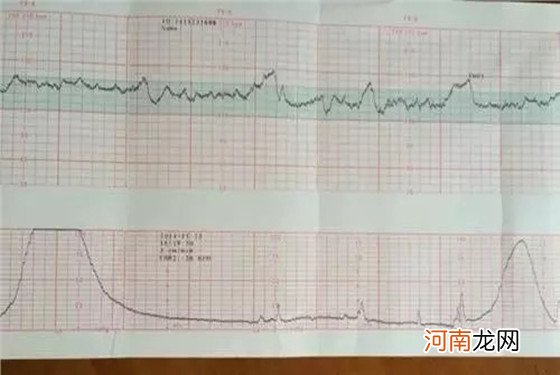 胎儿心跳每分钟多少次正常 一般来讲都是=这个数