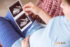 孕早期开始补充维生素 保证胎儿发育健康