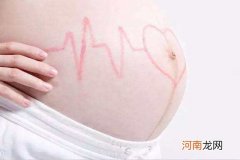 胎心率160生了个男孩 胎心看男女准吗？