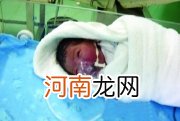 7月大女婴呛奶导致窒息昏迷 差点成植物人