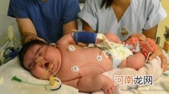 12斤女婴诞生破德国记录 警惕妊娠糖尿病致胎儿过重