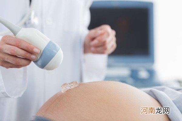 孕妇什么时候做四维最好 医生建议是这个孕周别做早了