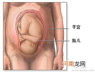 剖腹产后注意事项有哪些