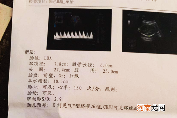 胎位loa和lop是什么意思 看了本文就知道