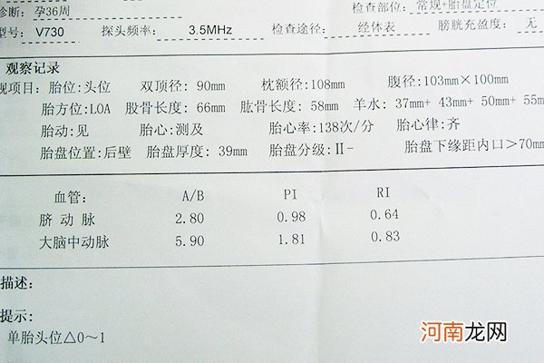 胎位loa和lop是什么意思 看了本文就知道