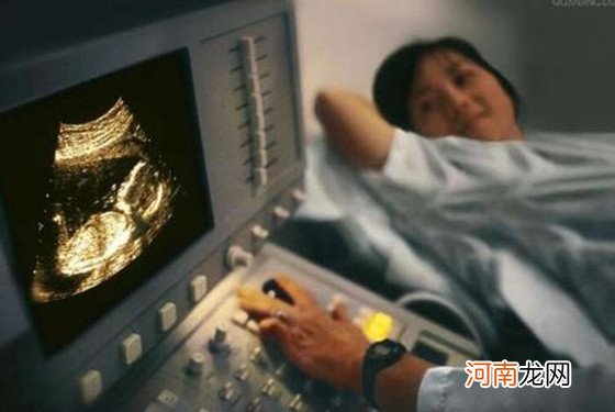 怎么算怀孕多少天 妇产科医生给你支3招