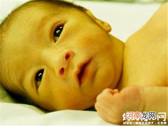 新生儿黄疸该如何护理 关于新生儿黄疸这些事要知道