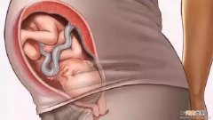 孕晚期帮助入盆动作