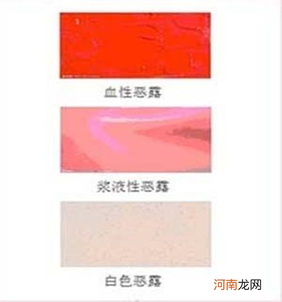 从顺产后恶露颜色变化图 探究产后恶露颜色变化的奥秘