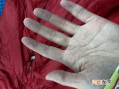 为什么冻僵的手不能用热水洗 冻僵的手不能用热水洗的原因