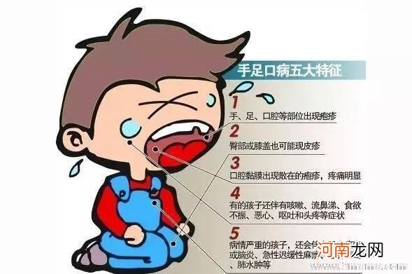 有什么方法预防手足口病呢