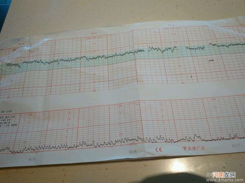 孕晚期胎监图怎么看