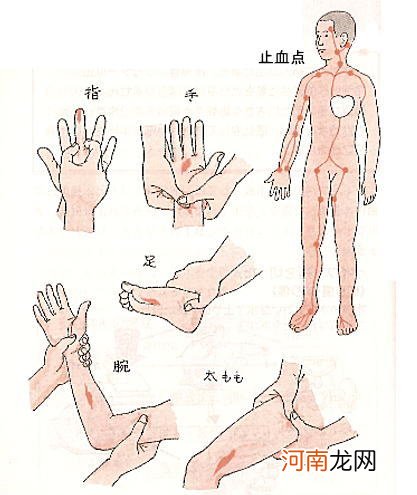 妈妈必学！六种止血方法