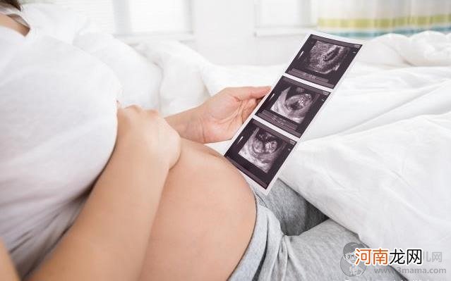 孕期到了这一周，胎位基本就固定了，想顺产的孕妈要多留心 - 顺产