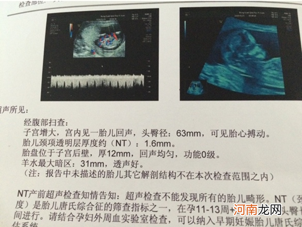 如何看懂nt检查报告单 上面真有男女暗示吗