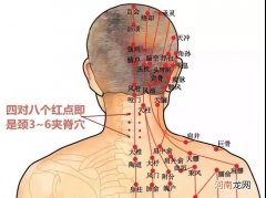 颈椎疼有啥症状 肩椎颈椎痛有什么症状