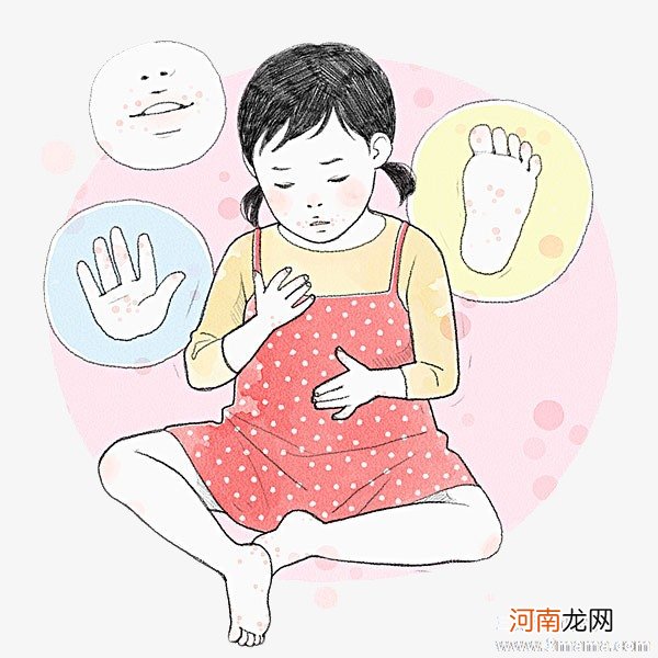 幼儿手足口病的有效预防措施