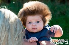 宝宝头发总是竖起来怎么办 宝宝头发竖起来有这些原因