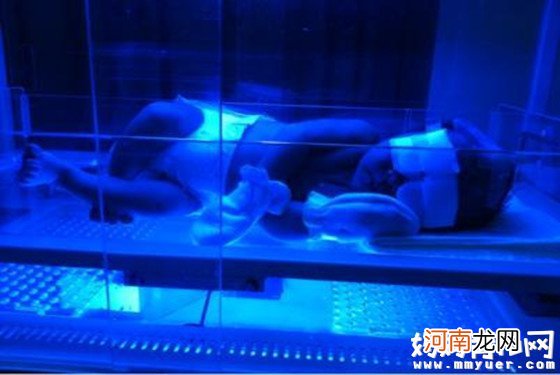 【什么是溶血性黄疸】溶血性黄疸病因 溶血性黄疸好治吗