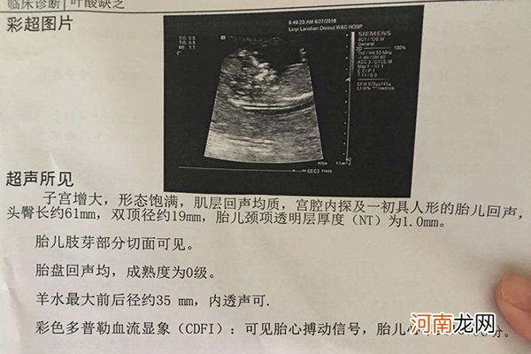 nt单子图片上面F是什么意思 是暗示胎儿性别吗