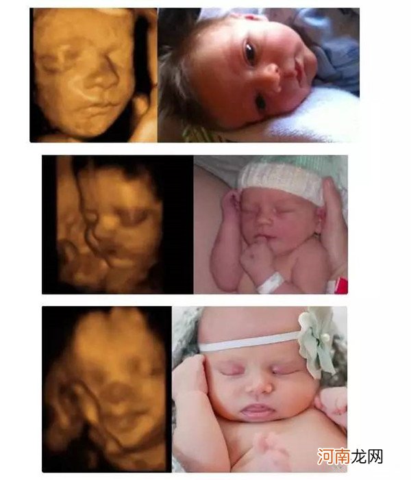 女宝四维图有哪些特点 四维照片跟真婴儿对比