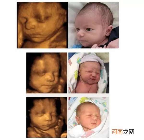 女宝四维图有哪些特点 四维照片跟真婴儿对比
