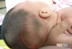 婴儿头发偏黄 宝宝头发偏黄是什么原因引起的
