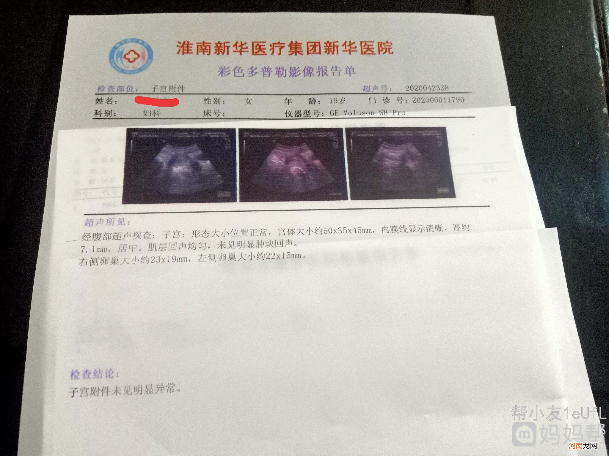 怀孕6周b超看不到孕囊