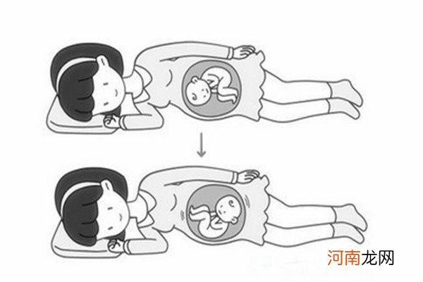 胎位臀位是睡太多的原因吗 胎儿臀位如何纠正能否顺产