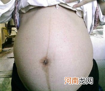 婚后第一胎为啥不宜做人流