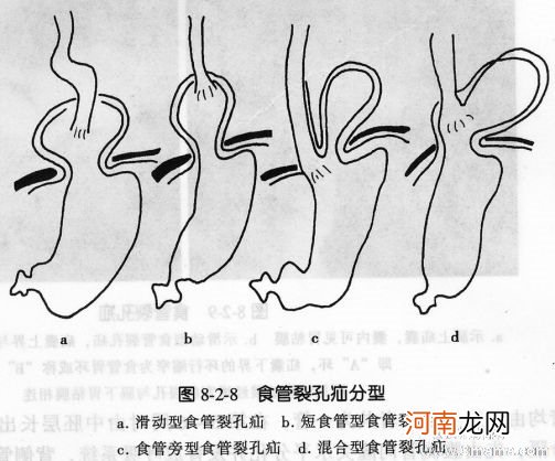 手足口病和哪些疾病需要做鉴别诊断