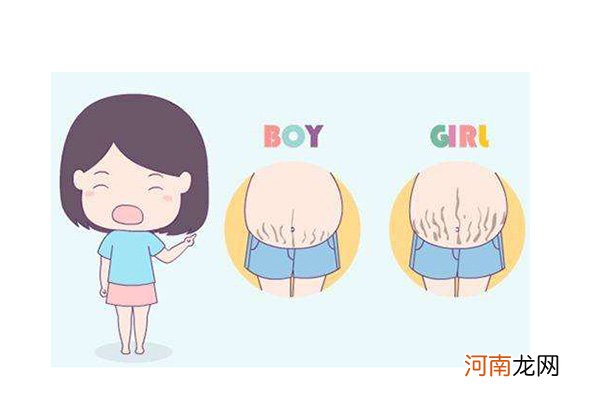 妊娠线看男女准不准 妊娠线和胎儿性别关系看过就懂了