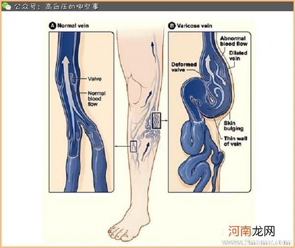 孕晚期小腹跳动为什么