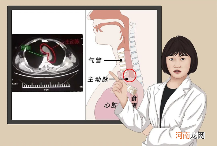 5岁儿子鱼刺卡喉，妈妈60秒处理很有用，医生：不用来医院