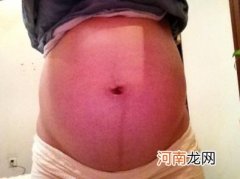 生男生女：五大症状透露胎儿性别