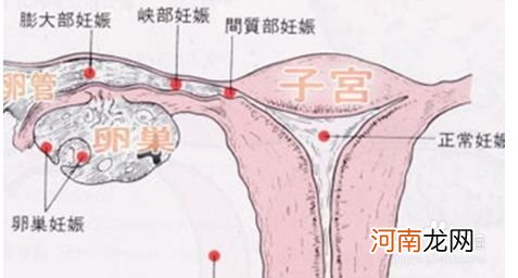 怀孕三个月流血了是怎么回事