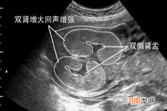 关于四维单子3秒钟看男是女靠谱吗 真相原来如此