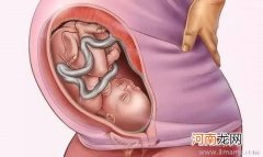 孕吐严重或影响胎儿孕妈妈应该怎么办