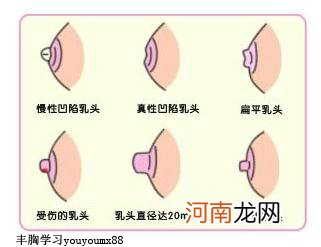 乳头下陷怎么回事?