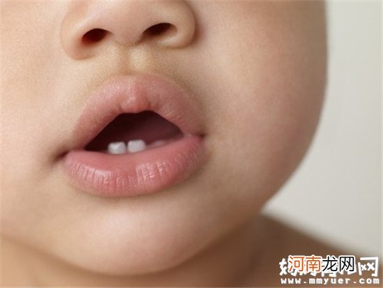 宝宝出牙晚就是缺钙吗 宝宝长牙相关知识家长要知