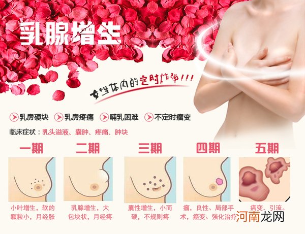 乳腺增生是什么症状图片